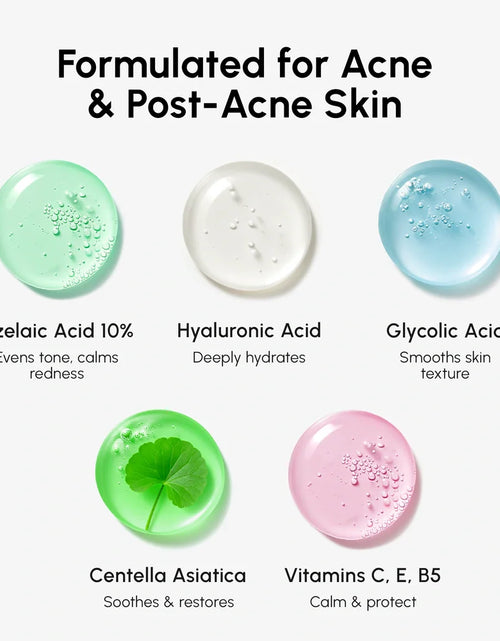Load image into Gallery viewer, Azelaic Acid Soothing Pads
