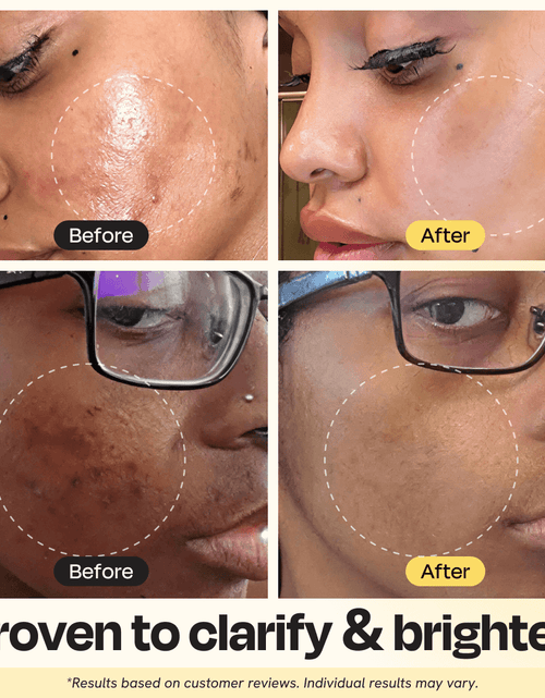 Load image into Gallery viewer, Vitamin C Clay Mask
